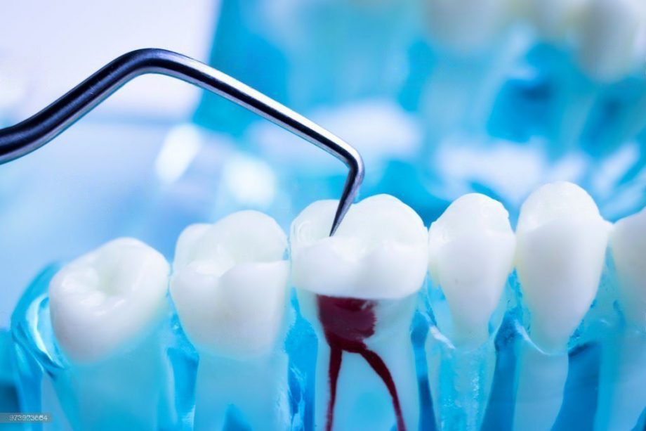What are the Differences Between an Endodontist and an Oral Surgeon